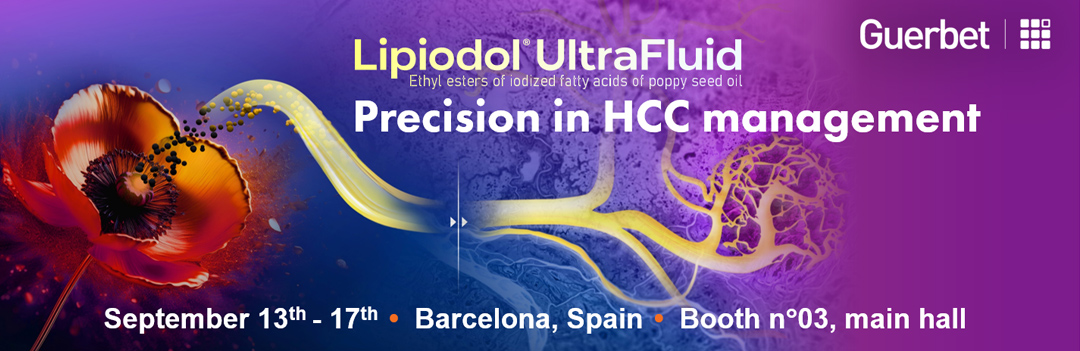 Master Vascular Embolization