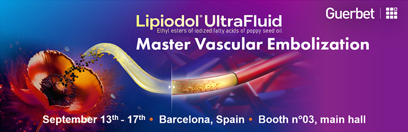 Master Vascular Embolization
