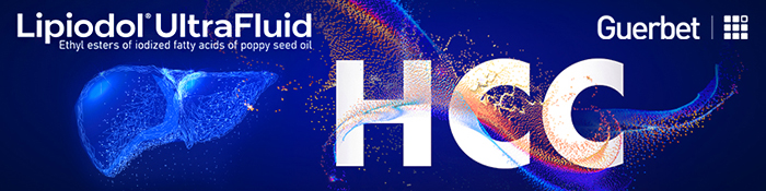 Lipiodol UltraFluid in HCC