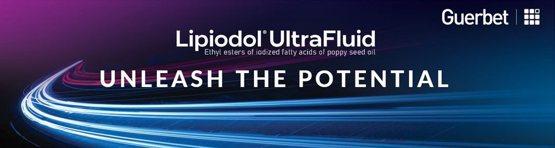 Unleash the potential